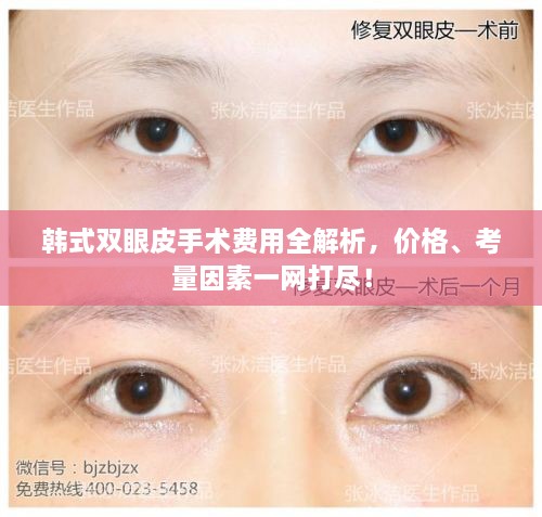 韓式雙眼皮手術費用全解析，價格、考量因素一網打盡！