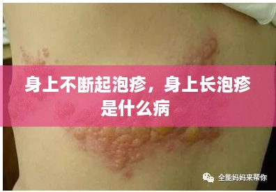身上不斷起泡疹，身上長泡疹是什么病 