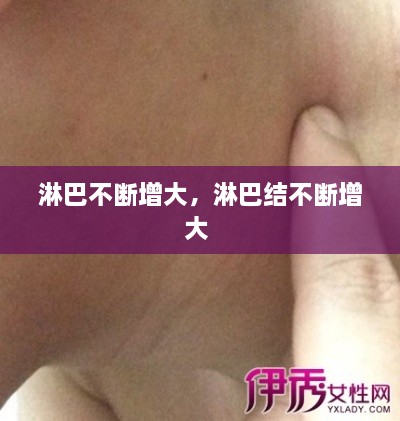 淋巴不斷增大，淋巴結(jié)不斷增大 