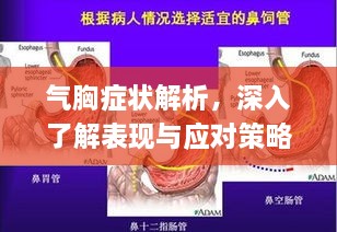 氣胸癥狀解析，深入了解表現(xiàn)與應(yīng)對(duì)策略