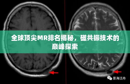 全球頂尖MR排名揭秘，磁共振技術(shù)的巔峰探索