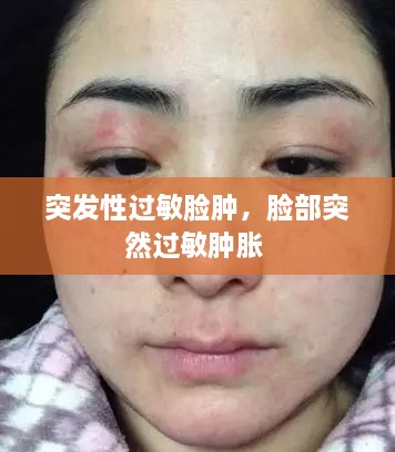 突發(fā)性過敏臉腫，臉部突然過敏腫脹 