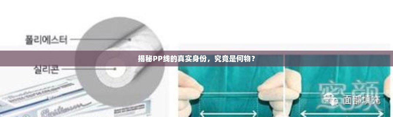 揭秘PP線的真實身份，究竟是何物？
