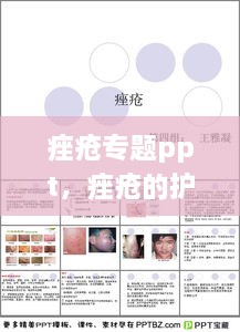 痤瘡專題ppt，痤瘡的護理ppt 