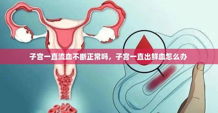 子宮一直流血不斷正常嗎，子宮一直出鮮血怎么辦 