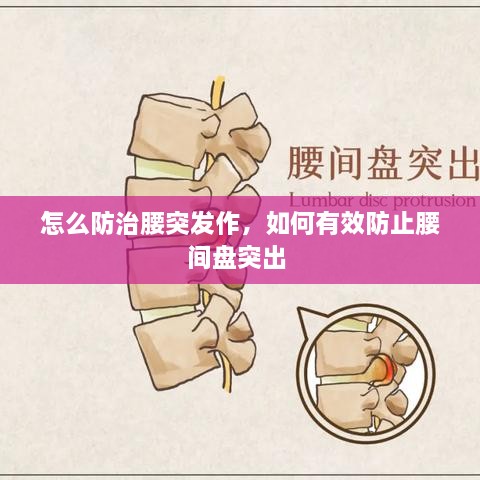 怎么防治腰突發(fā)作，如何有效防止腰間盤突出 