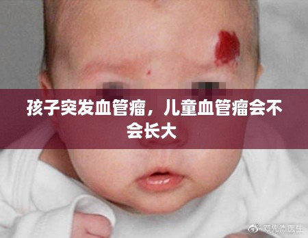 孩子突發(fā)血管瘤，兒童血管瘤會不會長大 