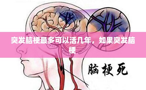 突發(fā)腦梗最多可以活幾年，如果突發(fā)腦梗 