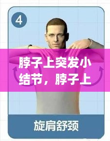 脖子上突發(fā)小結節(jié)，脖子上的小結節(jié)要緊嗎 