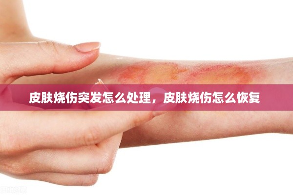 皮膚燒傷突發(fā)怎么處理，皮膚燒傷怎么恢復(fù) 