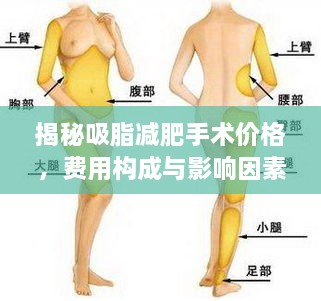 揭秘吸脂減肥手術(shù)價格，費(fèi)用構(gòu)成與影響因素全解析